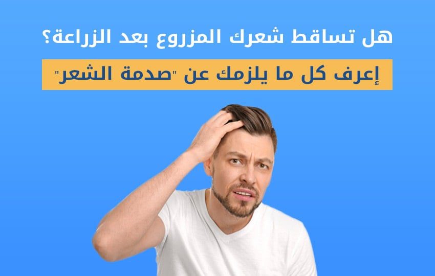 ما هي صدمة الشعر بعد الزراعه؟ | مركز اليت هير