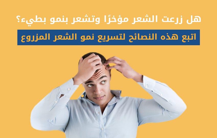نصائح لتسريع نمو الشعر المزروع