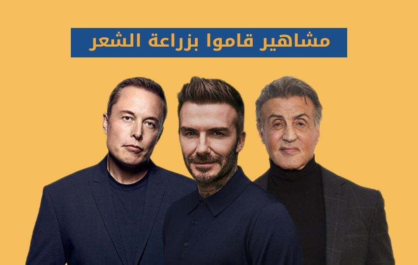 مشاهير قاموا بزراعة الشعر مركز اليت هير لزرعة الشعر