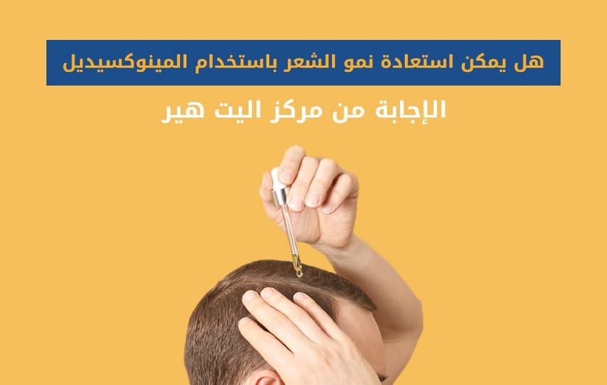 نمو الشعر باستخدام المينوكسيديل