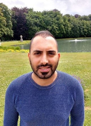 السيد مجد بعد عملية زراعة الشعر في إليت هير بـ 3 أشهر