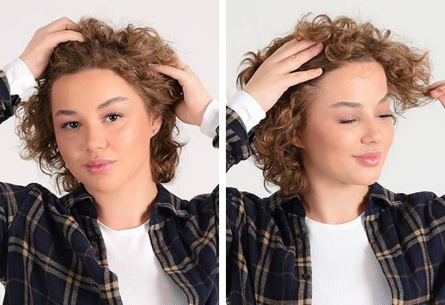 نتائج عملية زراعة الشعر للسيدة ليليانا مركز اليت هير