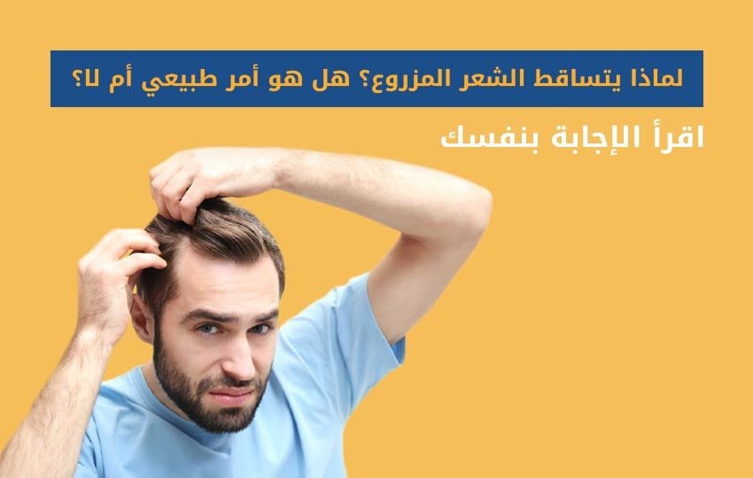 اسباب تساقط الشعر المزروع بعد زراعة الشعر