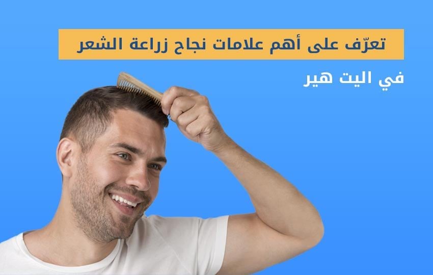 العلامات التي تدل على نجاح زراعة الشعر في تركيا