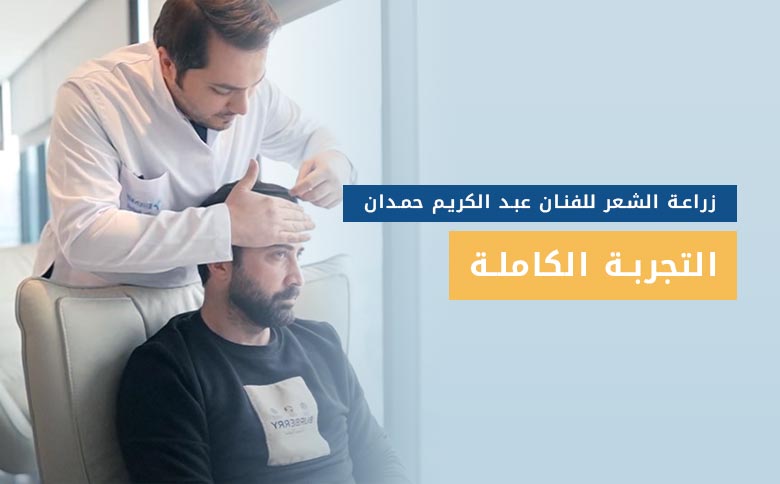 تجارب زراعة الشعر في تركيا للفنان عبد الكريم حمدان