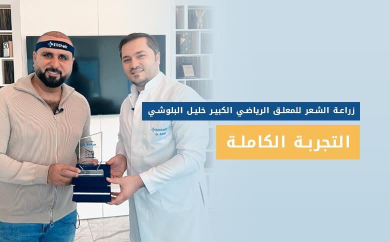 تجربة زراعة الشعر في تركيا لخليل البلوشي
