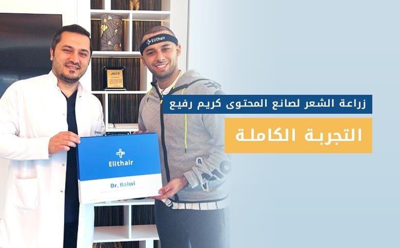 تجربة زراعة الشعر في تركيا لصانع المحتوى كريم رفيع