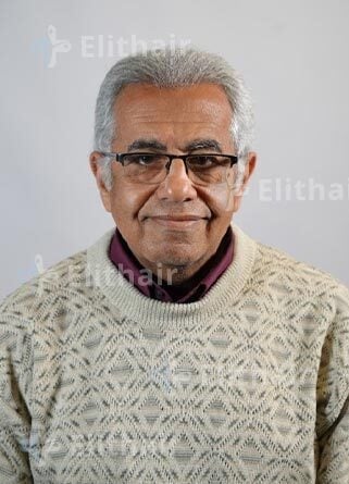 عاطف لاوندي-نتائج-زراعة-الشعر-في-مركز-اليت-هير