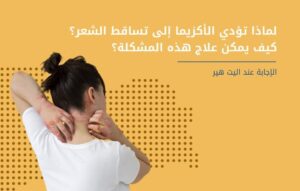 الاكزيما الدهنية وتساقط الشعر