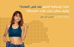 تساقط الشعر بعد عملية قص المعدة- مركز اليت هير
