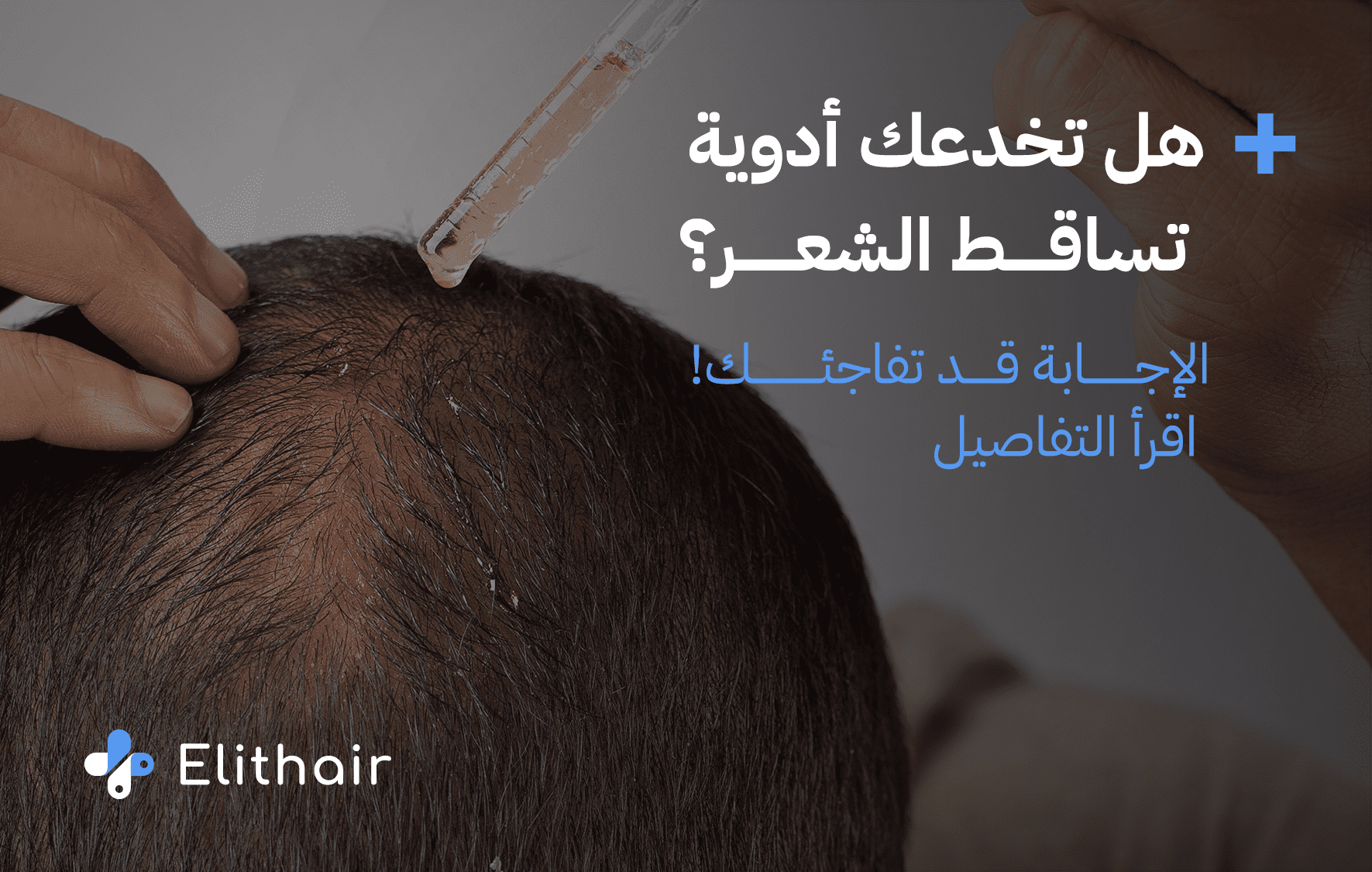 هل تقدم الأدوية طريقة فعالة لعلاج تساقط الشعر