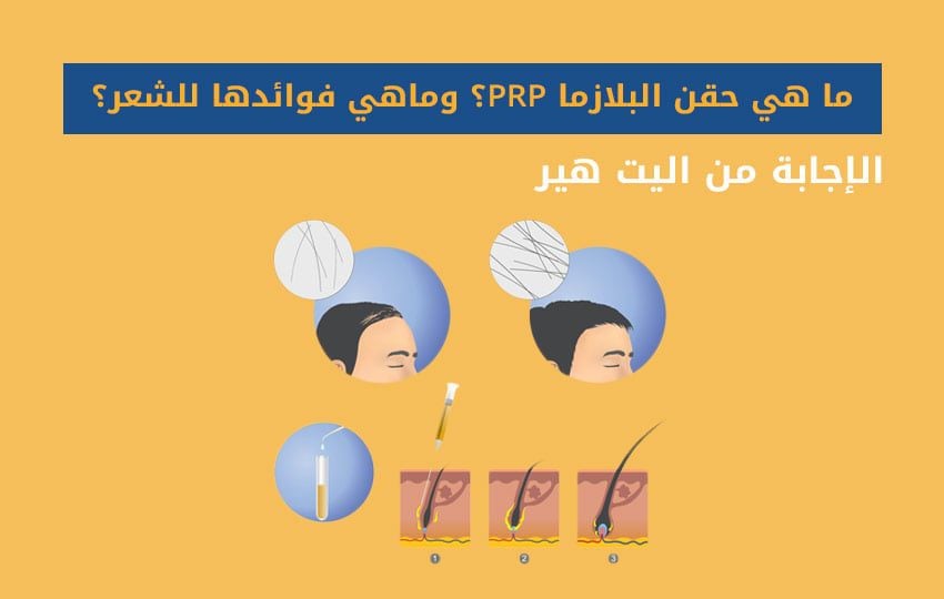 فوائد حقن البلازما للشعر 