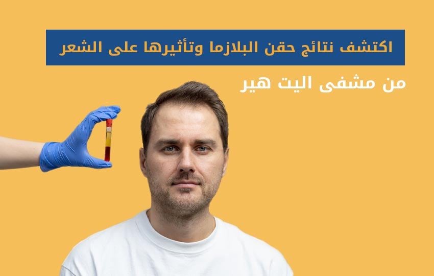 نتائج-حقن-البلازما-للشعر-مركز-اليت-هير-لزراعة-الشعر-