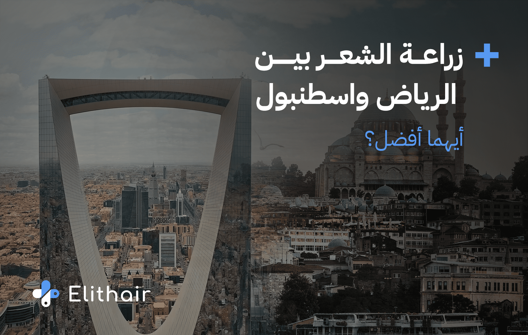 أين تزرع شعرك؟ في الرياض أم إسطنبول
