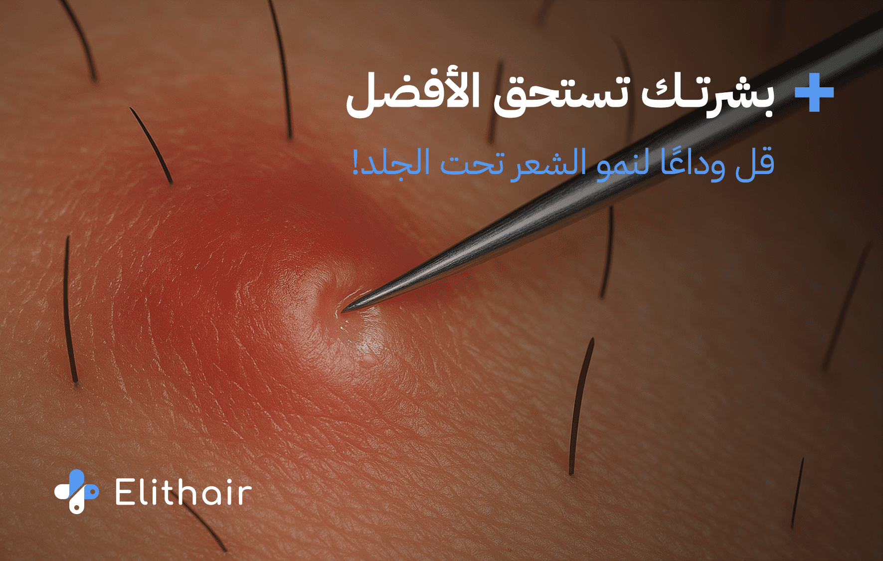 اسباب نمو الشعر تحت الجلد وطرق العلاج الفعالة