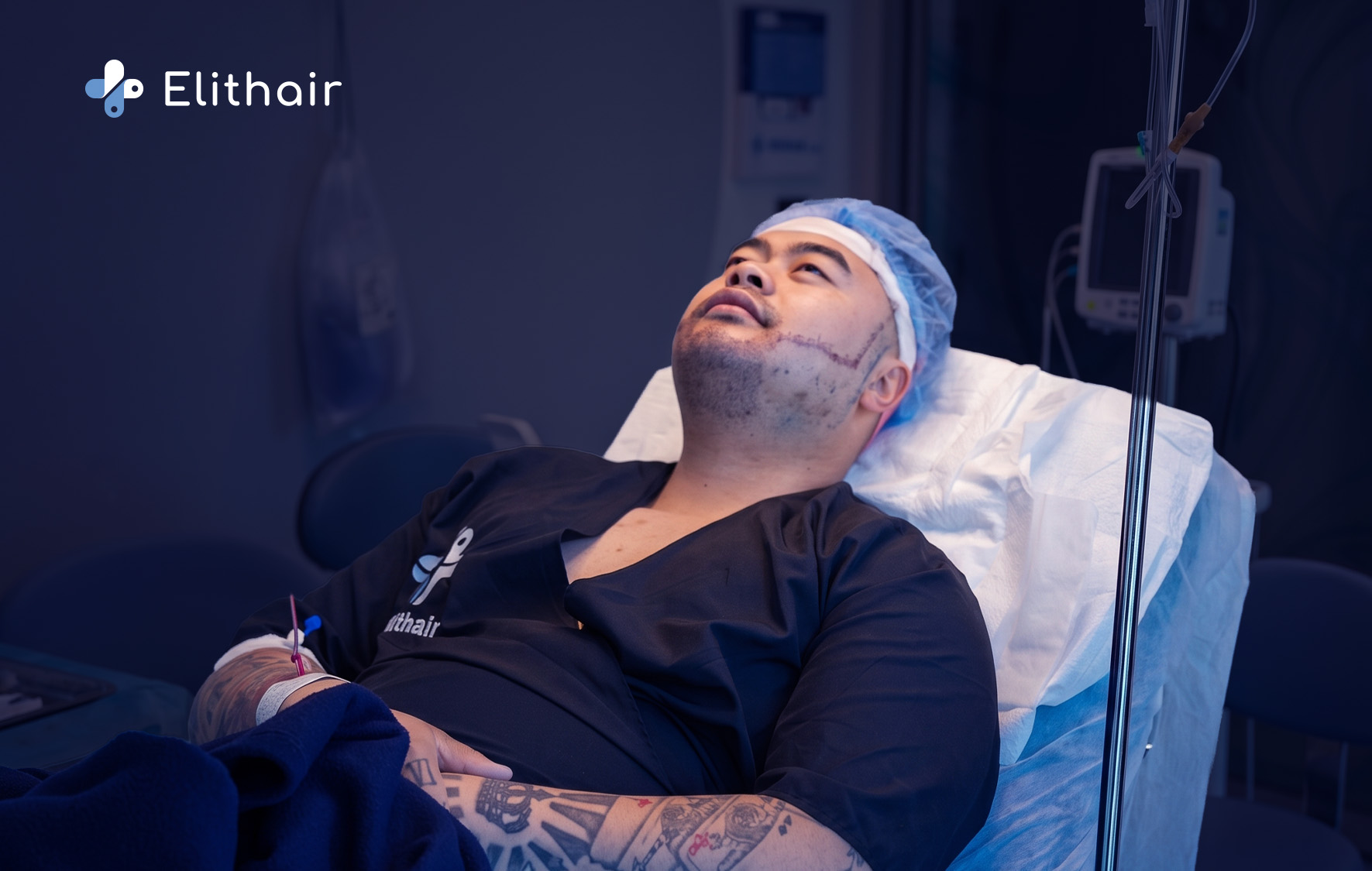 طرق زراعة شعر اللحية والشنب في تركيا