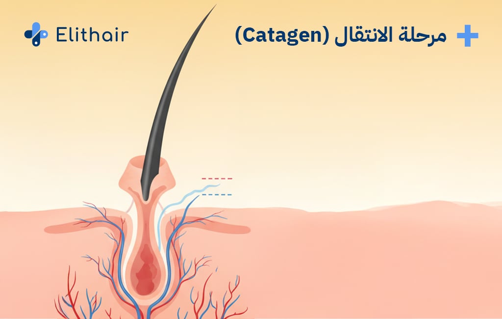 مرحلة الانتقال من مراحل نمو الشعر