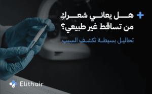 التحاليل المطلوبة لمعرفة تساقط الشعر للنساء