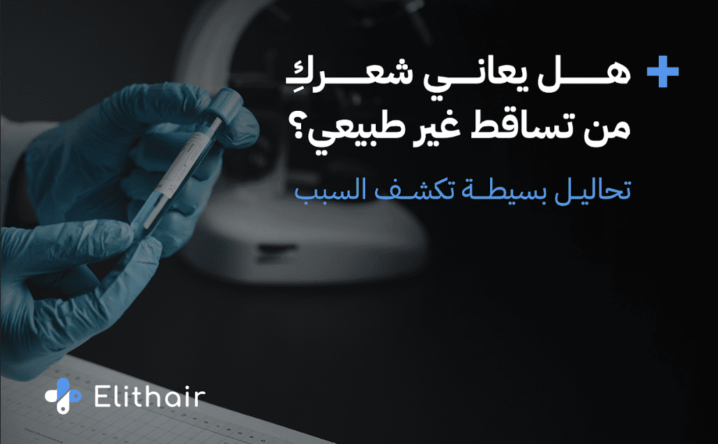 التحاليل المطلوبة لمعرفة تساقط الشعر للنساء