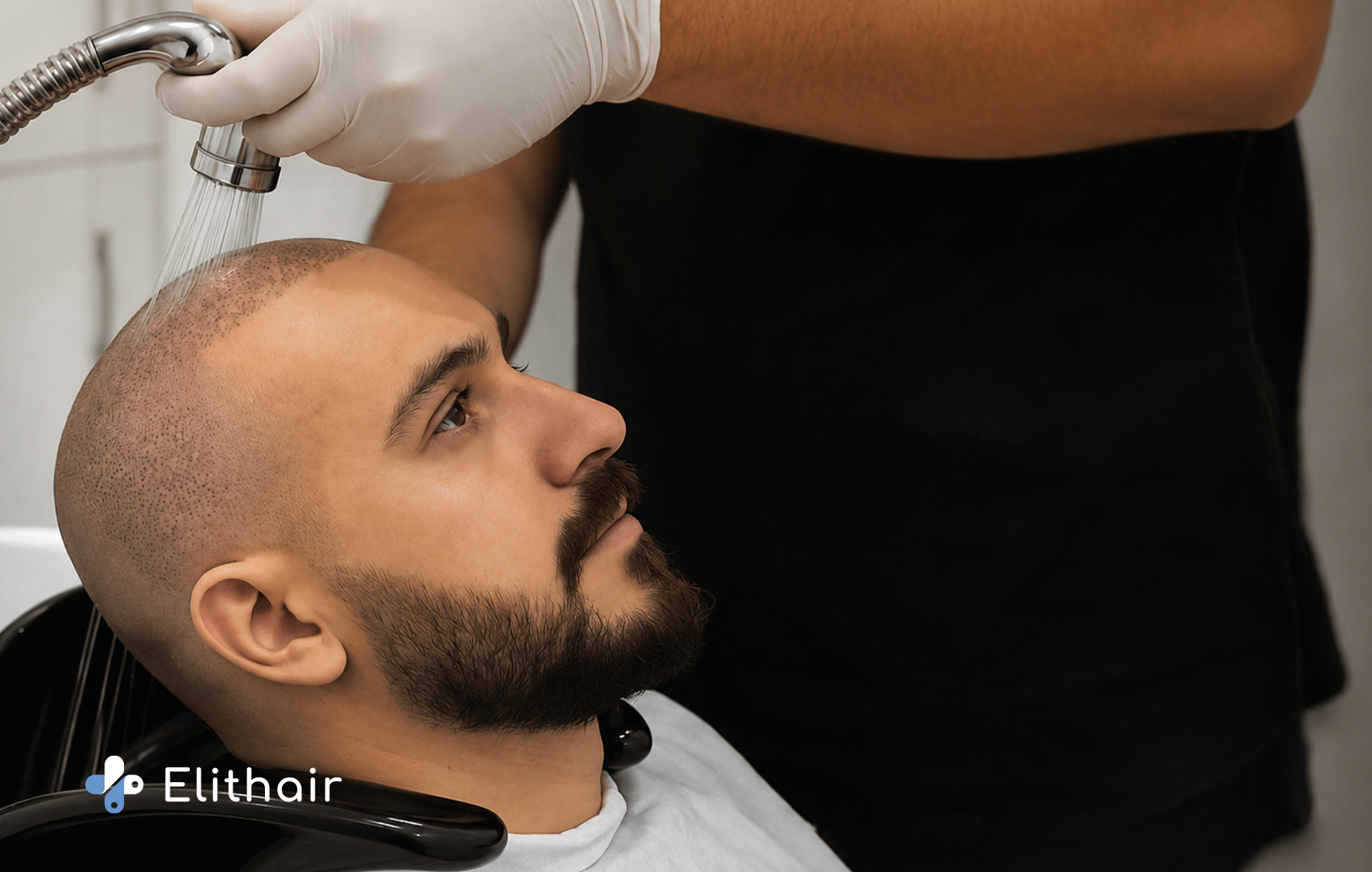 الطريقة الصحيحة لغسل الشعر بعد الزراعة