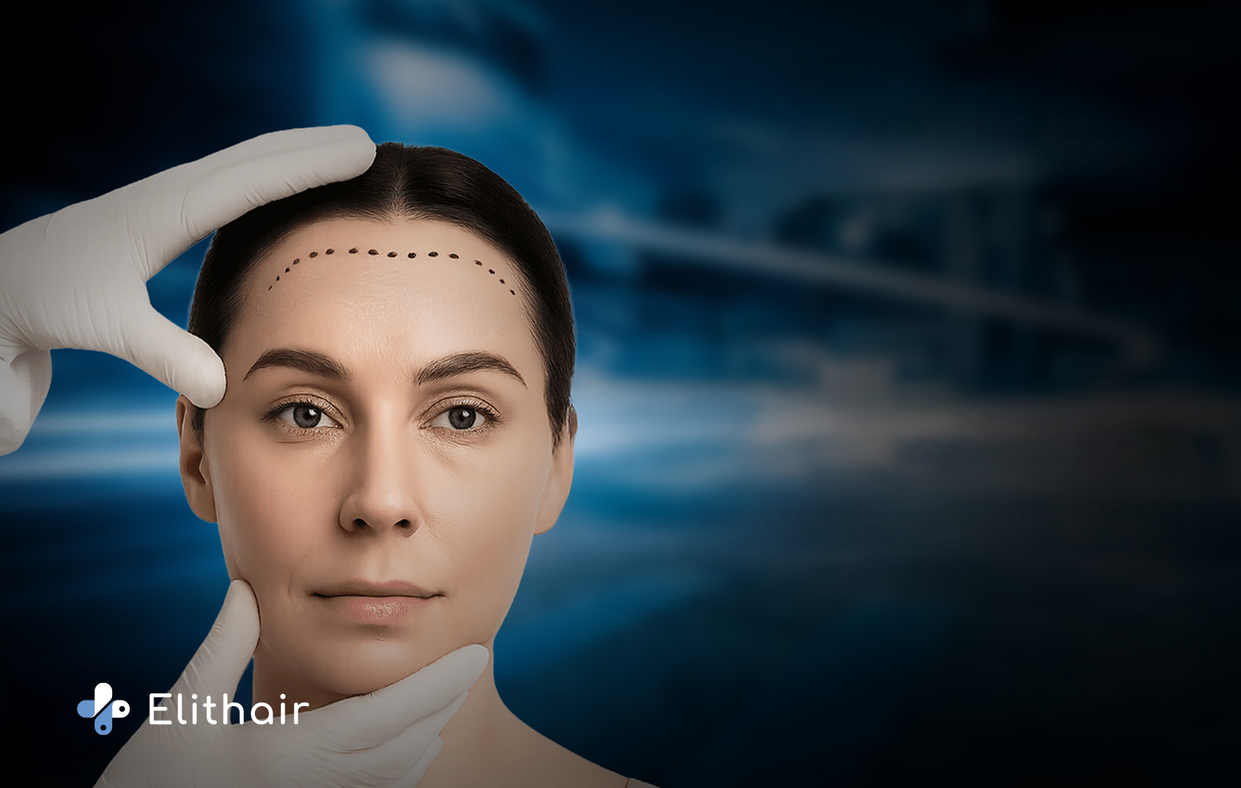 تصغير الجبهه للنساء في مركز اليت هير لزراعة الشعر