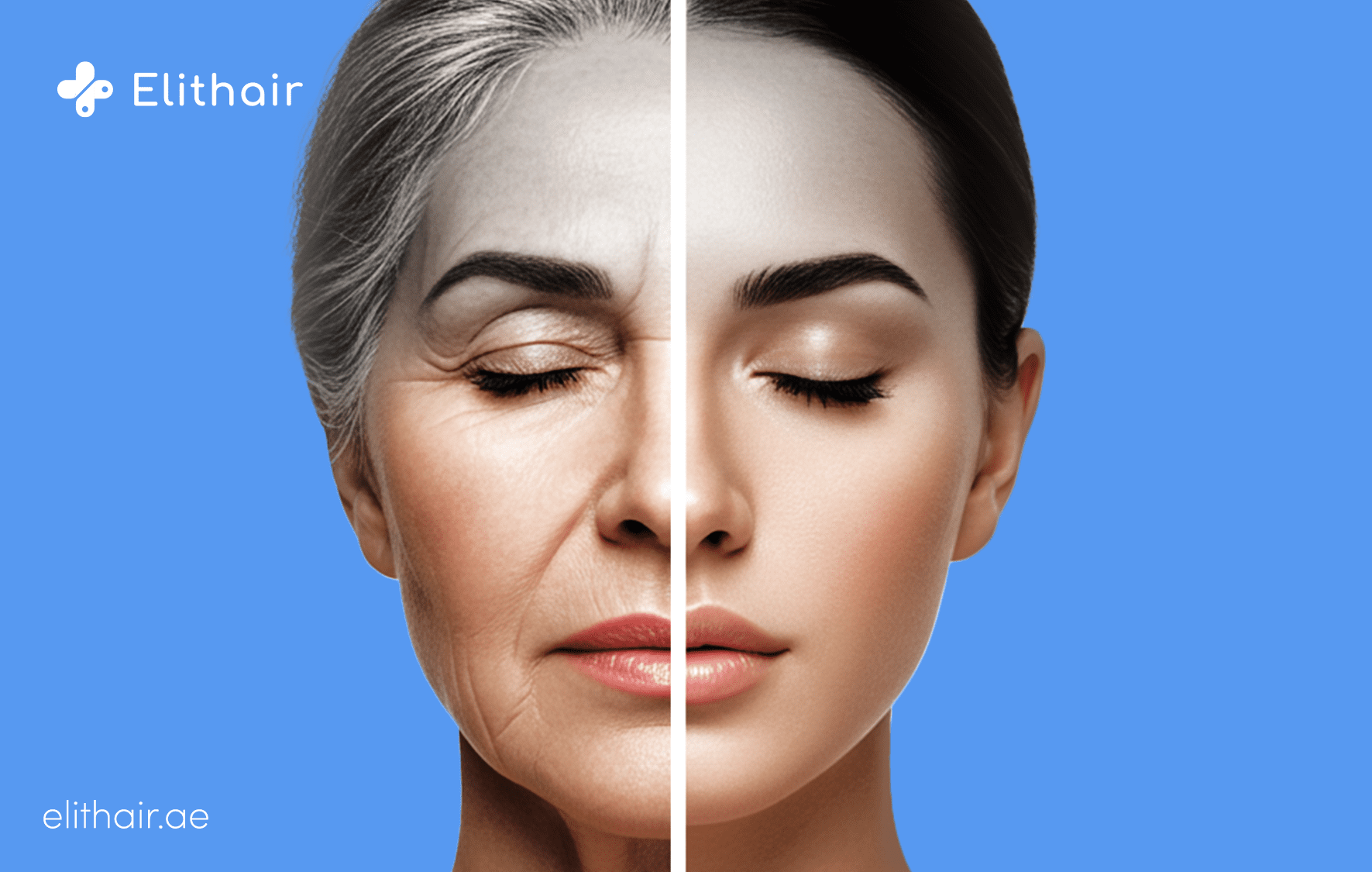 الخدمات التجميلية والسياحة العلاجية في تركيا - مركز اليت هير لزراعة الشعر