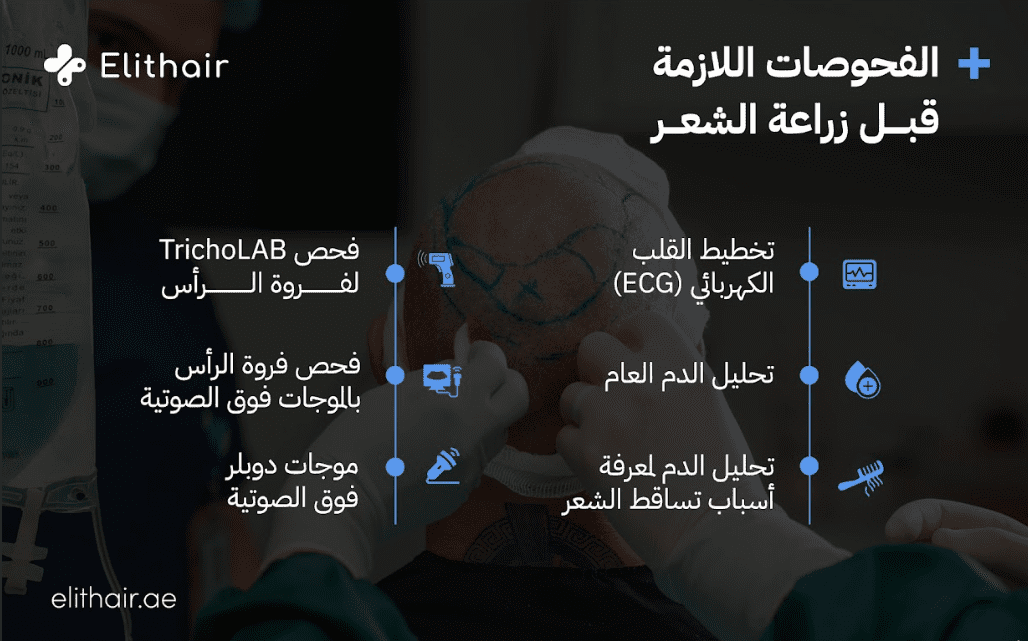 الفحوصات الطبية قبل زراعة الشعر