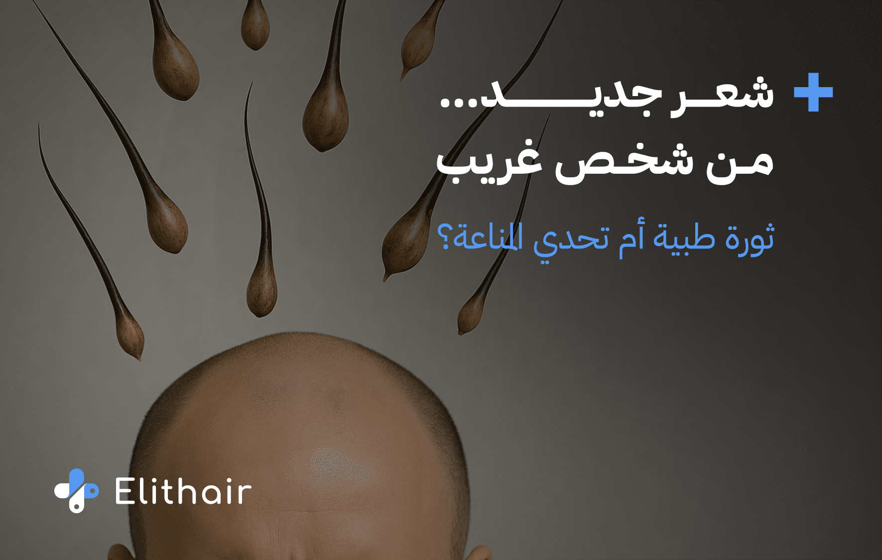 زراعة الشعر من شخص آخر - مركز اليت هير لزراعة الشعر