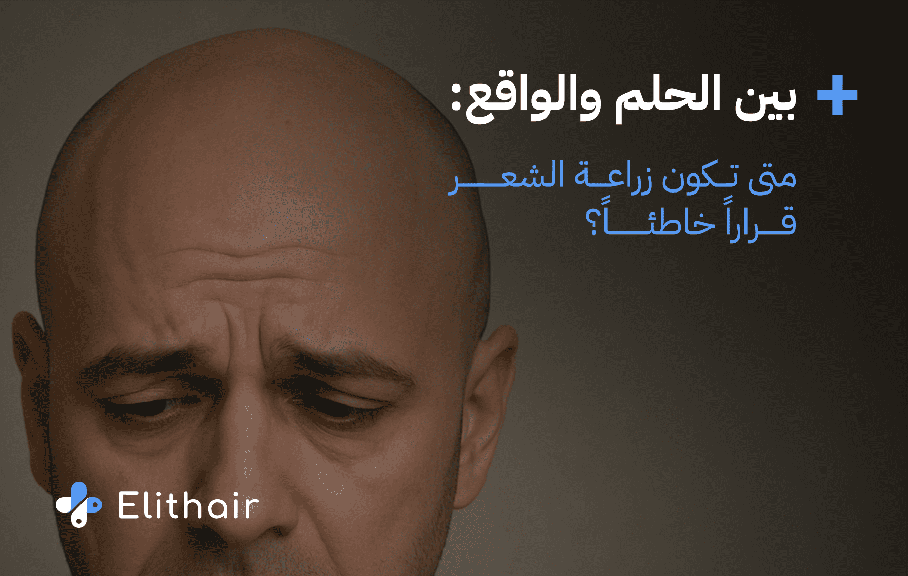 شروط زراعة الشعر- مركز اليت هير لزراعة الشعر