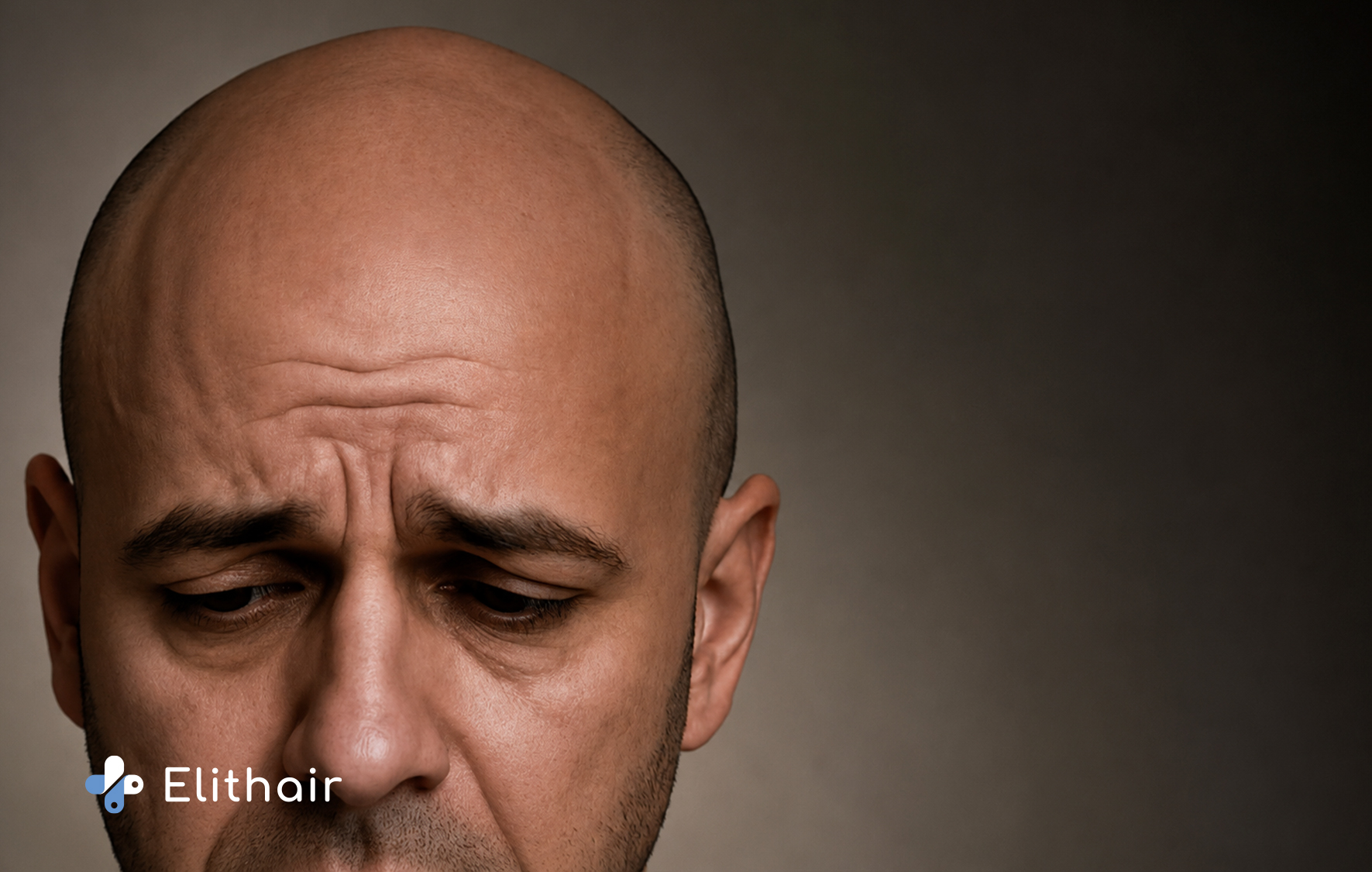 شروط زراعة الشعر- مركز اليت هير لزراعة الشعر