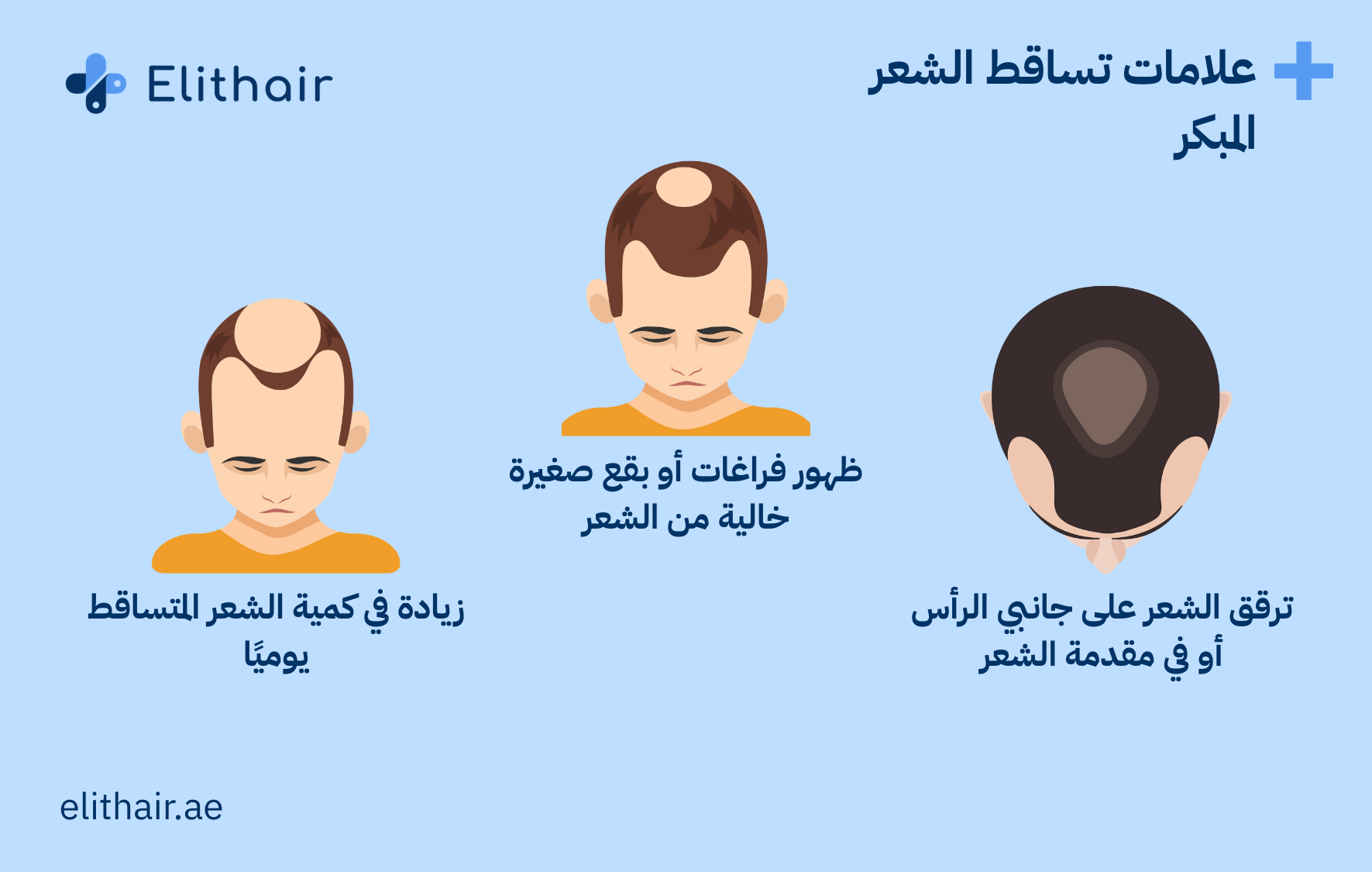 علامات تساقط الشعر المبكر عند الرجال - مركز اليت هير