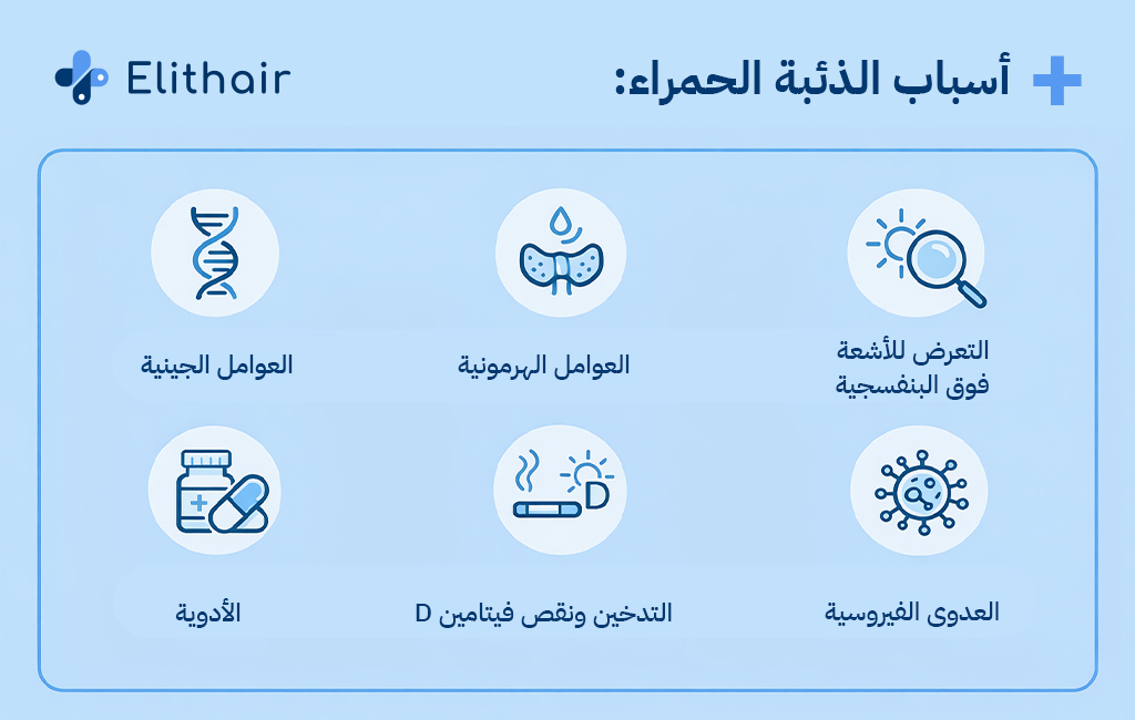 أسباب الذئبة الحمراء - مركز اليت هير لزراعة الشعر