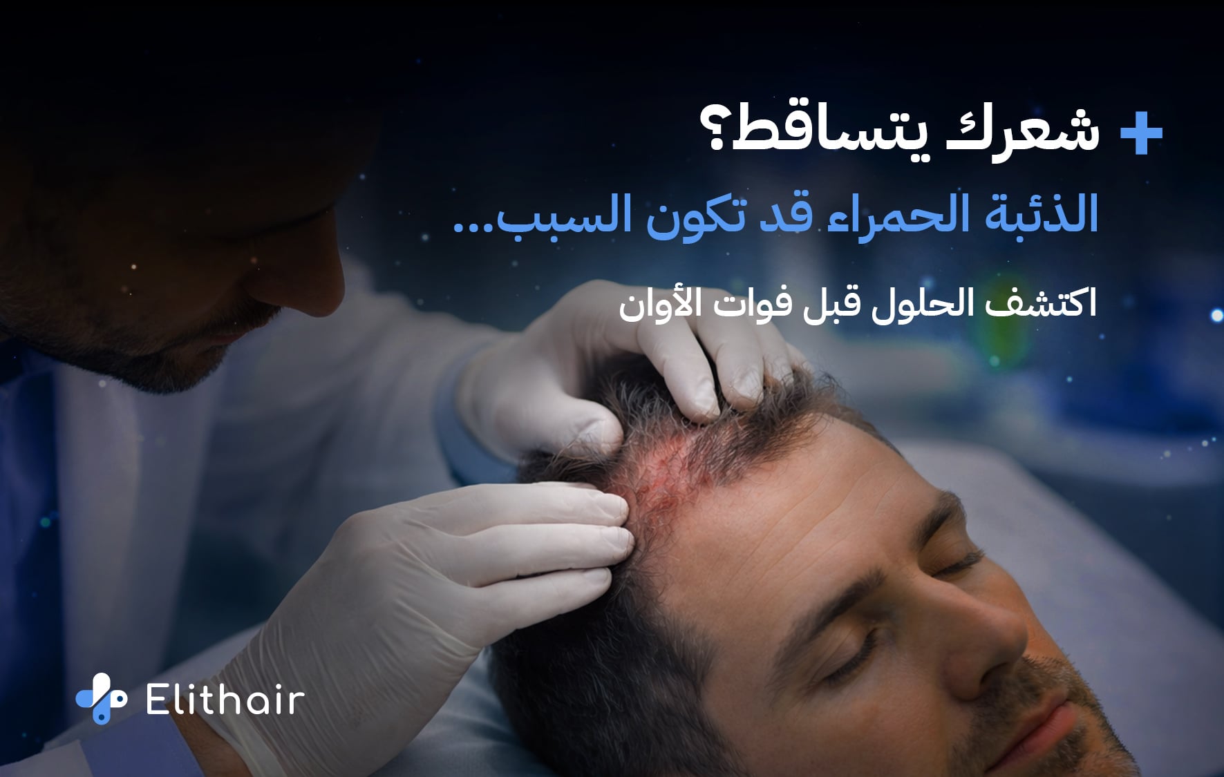 الذئبة الحمراء وعلاقتها بتساقط الشعر - مركز اليت هير لزراعة الشعر
