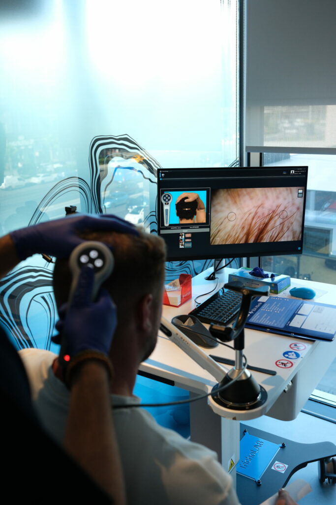 فحص رقمي لفروة الرأس باستخدام أجهزة وتقنيات متطورة لتحليل حالة الشعر وتقييم المنطقة المانحة قبل زراعة الشعر