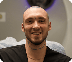التخدير لزراعة الشعر بتقنية deep-sleep