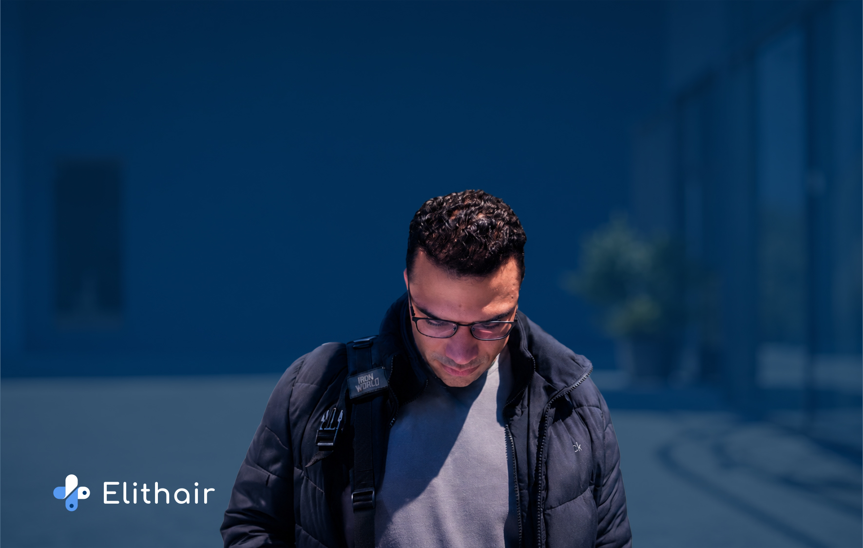 تجربة زراعة الشعر لحسن مصطفى في اليت هير