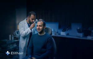 حالات لا تصلح لزراعة الشعر- مركز اليت هير لزراعة الشعر