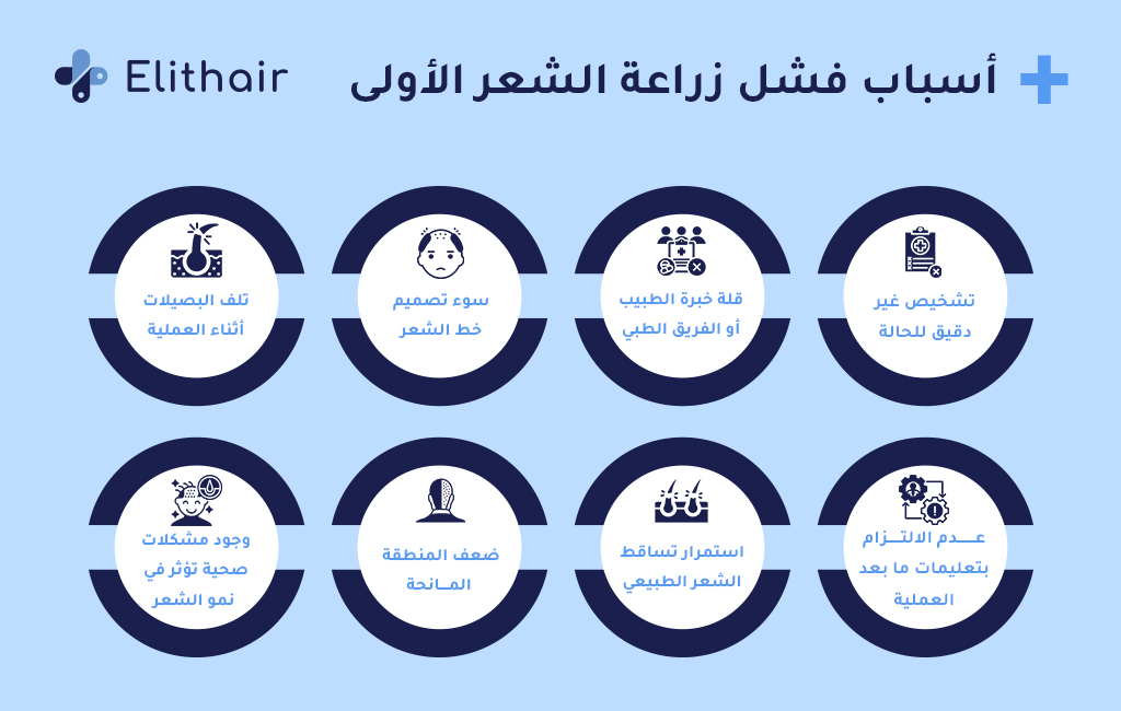 أسباب فشل زراعة الشعر الأولى - مركز اليت هير لزراعة الشعر