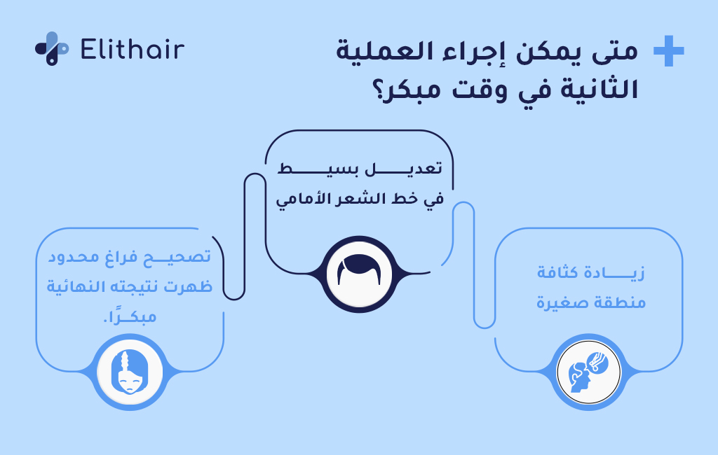 متى يمكن إجراء زراعة الشعر للمرة الثانية - مركز اليت هير لزراعة الشعر