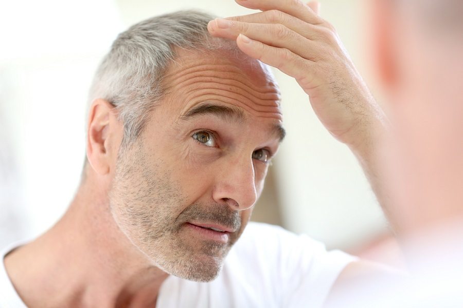 Haarausfall – und wie lichtes Haar die Dating