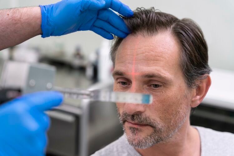 Patient wird vor einer Haartransplantation untersucht und beraten