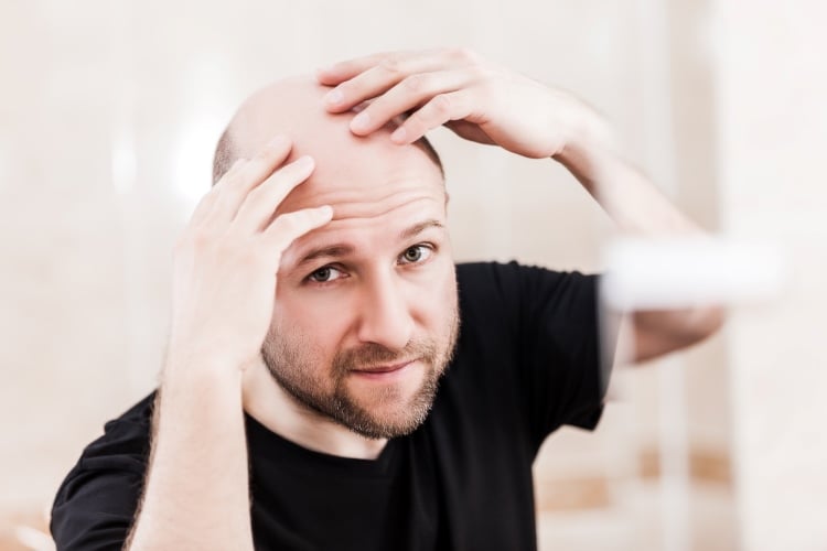 Mann mit Glatze fasst sich auf den Kopf