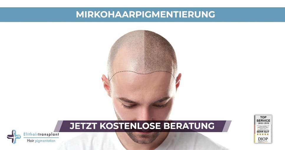 Die Haarpigmentierung kann kahle Stellen am Kopf wieder auffüllen Mann beugt sich nach vorne um vorher nachher Vergleich der Haarpigmentierung zu zeigen