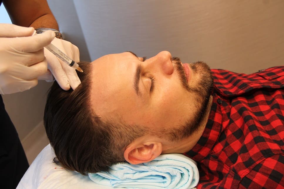 Bei der Eigenblutbehandlung wird ein Serum für Haarwachstum verabreicht Mann erhält eine PRP Behandlung mit Injektion