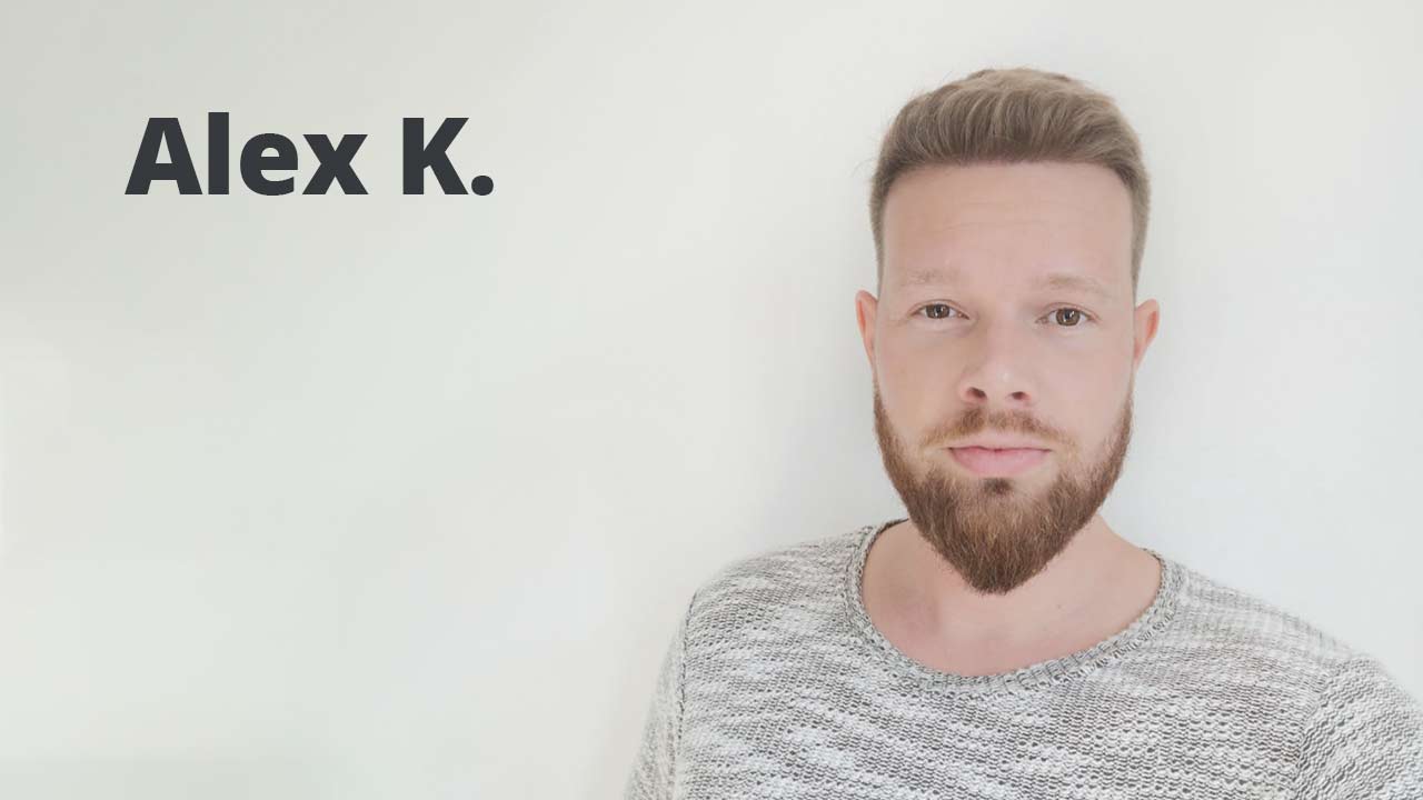 Thumbnail von Patient Alexander Kitzel bezüglich der Vorher Nachher Haartransplantation