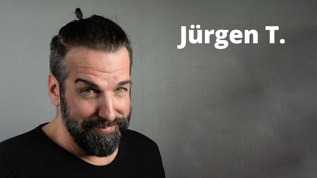 Thumbnail von Patient Jürgen T. bezüglich der Vorher Nachher Haartransplantation