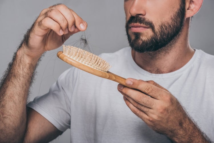 Mann hält Bürste mit Haaren nach plötzlichem Haarausfall in der Hand