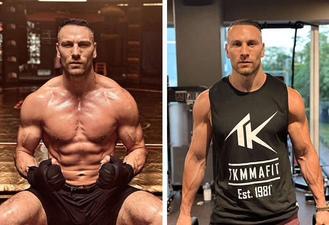 Kerim Engizek nach seiner Haartransplantation