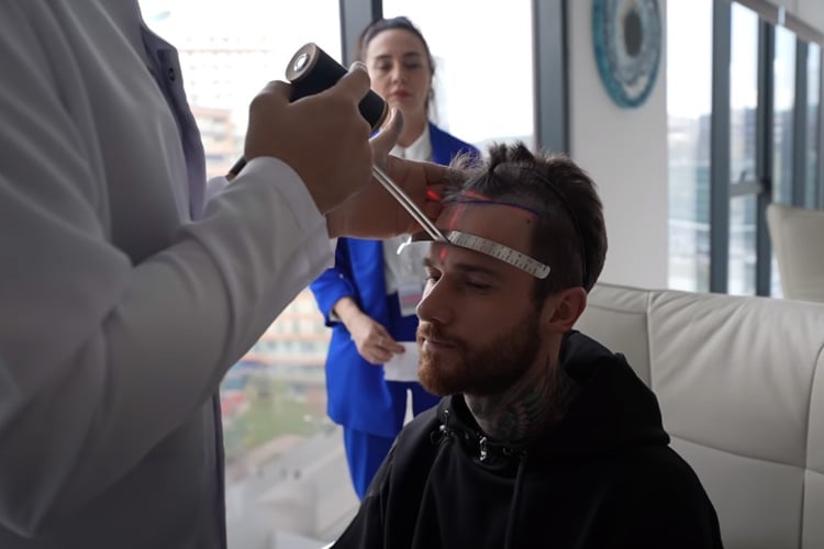 YouTuber Fabio Schäfer bei der Haaranalyse mit Dr. Balwi in der Elit-Klinik