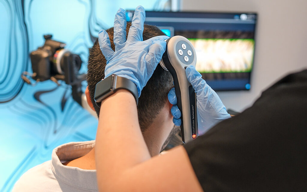 Digitale Haaranalyse des Spenderbereichs mit Spezialkamera